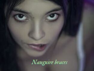 Nauguire_braces